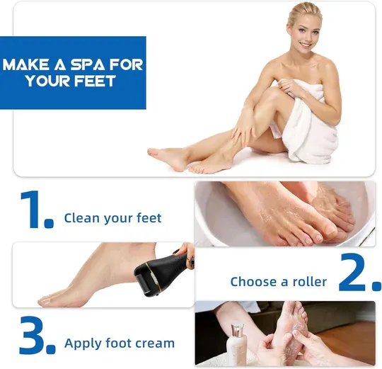 Electric Callus Remover